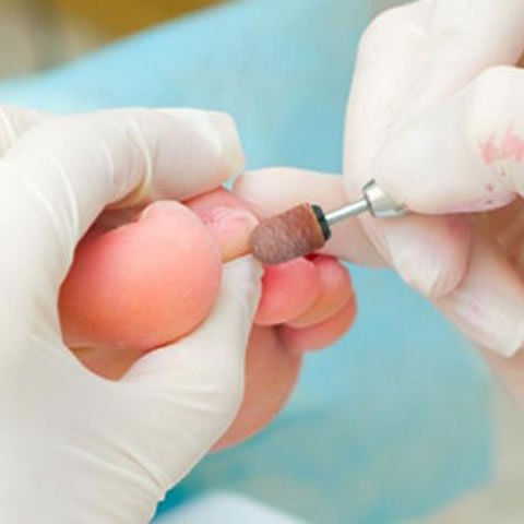 Podología en FisioClinics Podología en FisioClinics