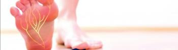 Fisioterapia en el tratamiento de la polineuropatía o neuropatías periféricas - FisioClinics Sabadell