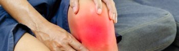 Alivio del Dolor de Rodilla: Estrategias para la Condromalacia Rotuliana