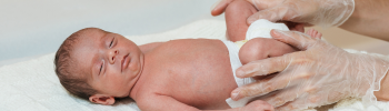 Fisioterapia para Bebés con Hipotonía: Terapias para Mejorar el Tono Muscular