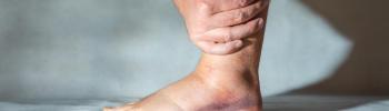 ¿Tu tobillo sigue fallando meses después del esguince? Lo que muchas personas no recuperan bien ¿Tu tobillo sigue fallando meses después del esguince? Lo que muchas personas no recuperan bien