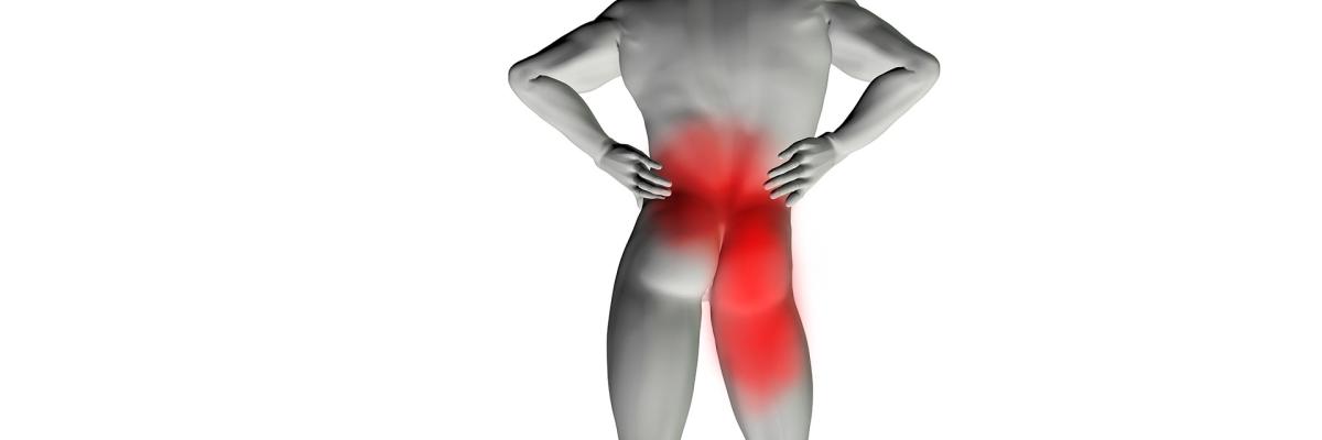 ¿Ciática o simple dolor de espalda? Cómo reconocer las señales y cuándo acudir al fisioterapeuta