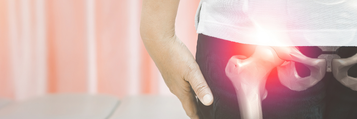 Ejercicios para fortalecer la musculatura en pacientes con artrosis de cadera