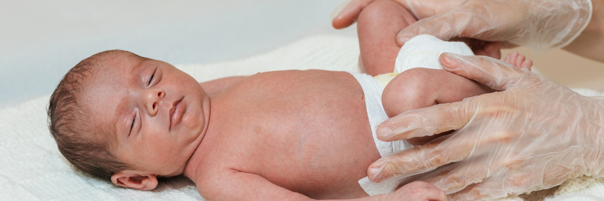 Fisioterapia para Bebés con Hipotonía: Terapias para Mejorar el Tono Muscular