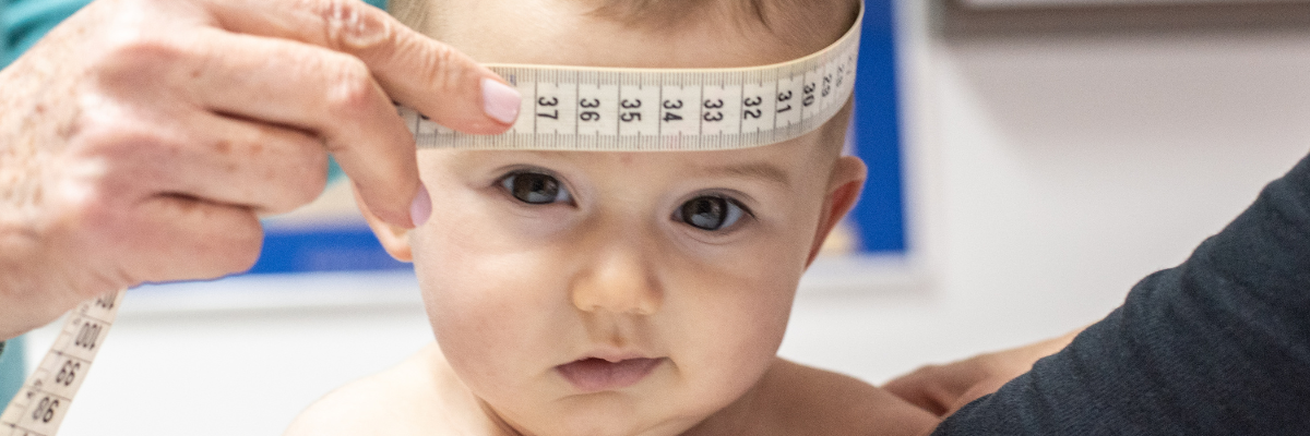Fisioterapia para Bebés con Asimetría Craneal: Estrategias para Corregir la Deformidad y Prevenir Problemas Futuros