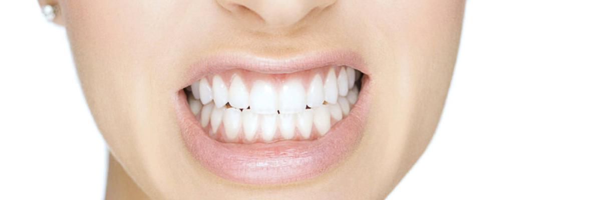 Rechinamiento de dientes o bruxismo ¿lo sufres? - FisioClinics Sabadell