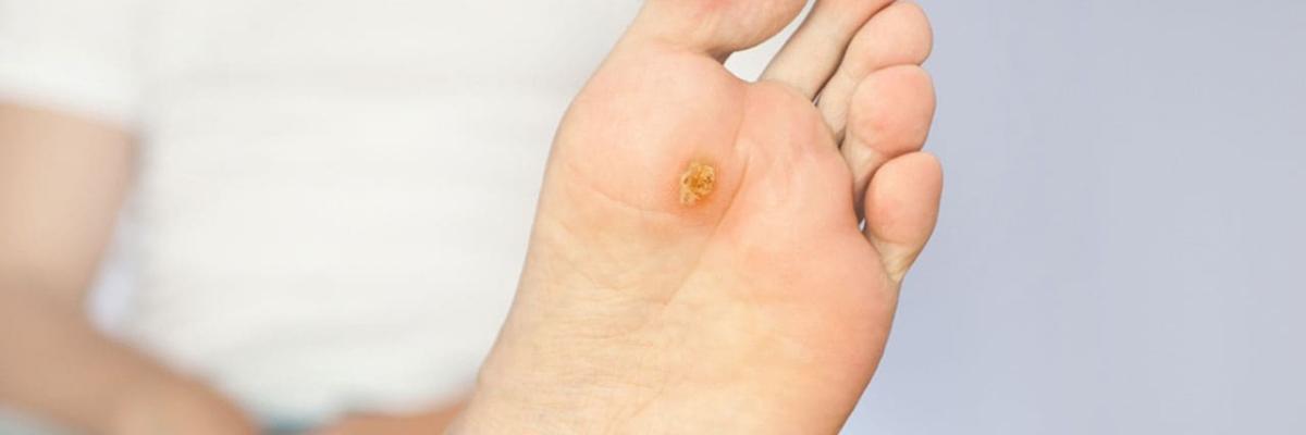 cómo la fisioterapia ayuda a prevenir complicaciones en Sabadell