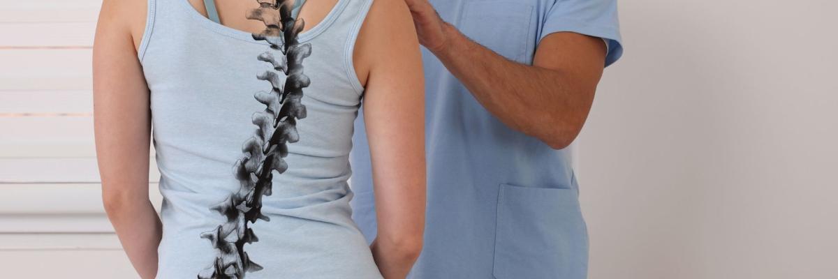 escoliosis funcional adulta