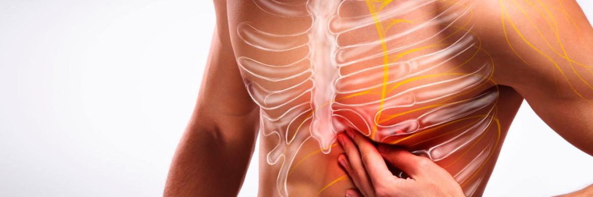 Terapias manuales para neuralgia intercostal: alivia el dolor sin medicamentos