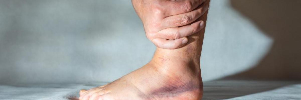 ¿Tu tobillo sigue fallando meses después del esguince? Lo que muchas personas no recuperan bien